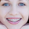 Фото.Что такое ортодонтия
